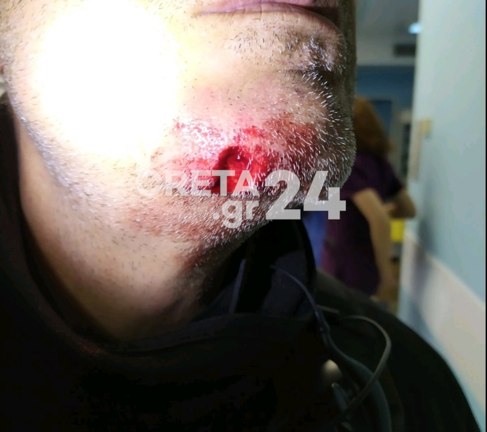 Σοκάρει η περιγραφή του αστυνομικού για την επίθεση που δέχθηκε από πολίτη