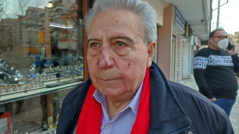 Αποκλειστικά στο TheOpinion ο ηλικιωμένος που πάλεψε με τους ληστές (pics & vid)