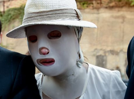 Επίθεση με βιτριόλι: Εικόνες από το νέο χειρουργείο της Ιωάννας Παλιοσπύρου