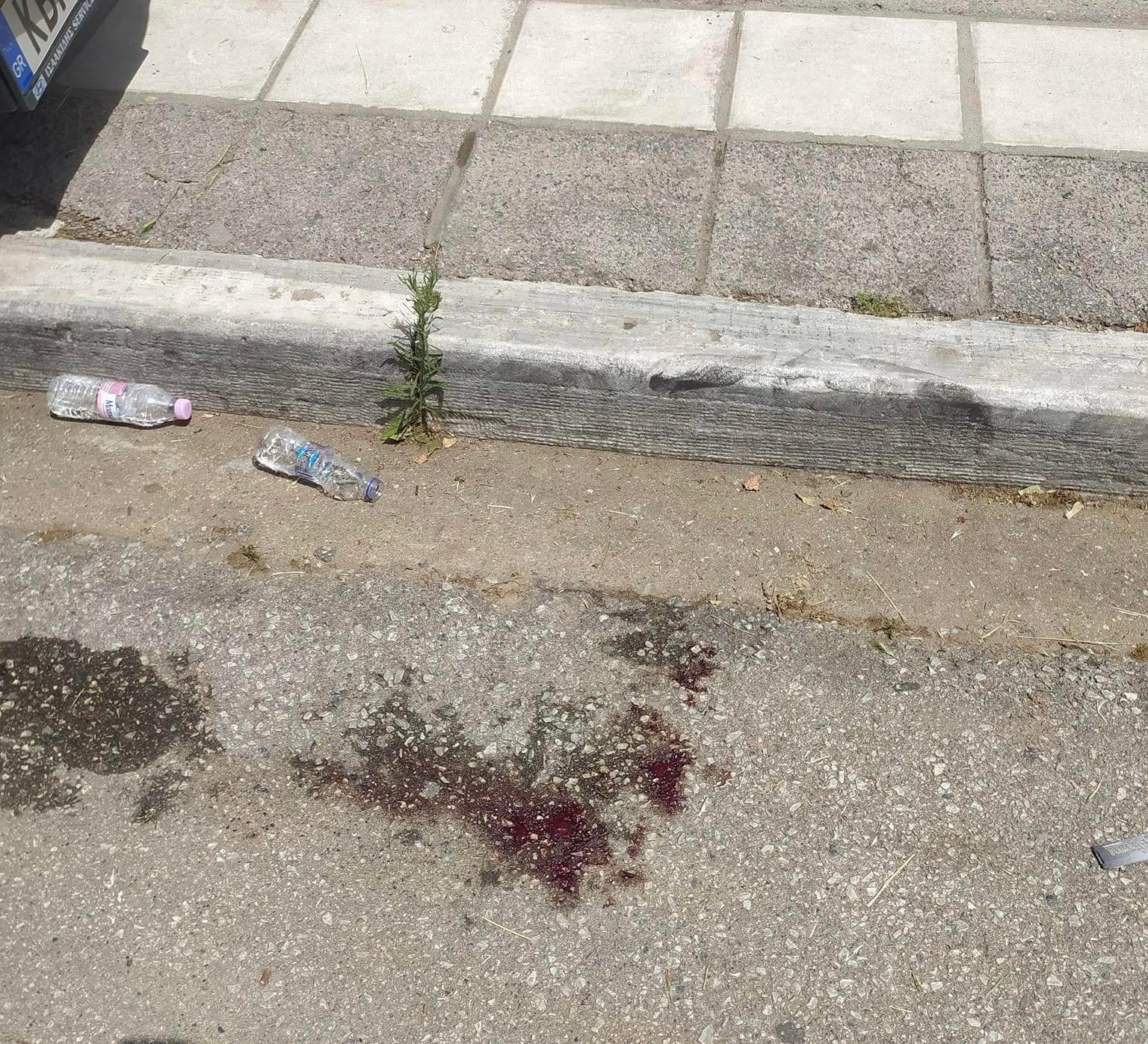 ΑΠΘ: Η εκδοχή της αστυνομίας για τον τραυματισμό του φοιτητή