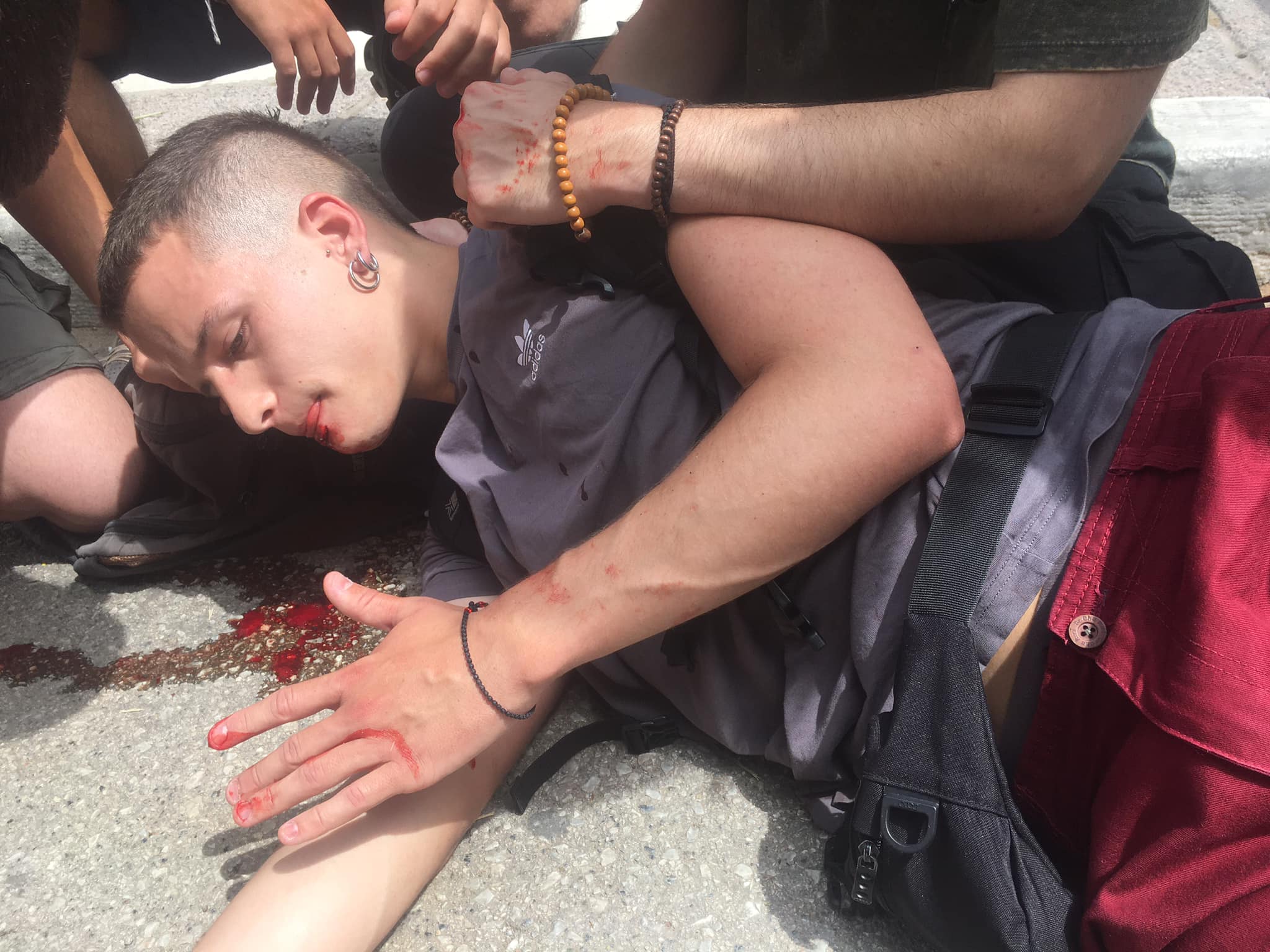 Επεισόδια στο ΑΠΘ – Ιπποκράτειο: Ο φοιτητής έχασε την ακοή και τα δόντια του (vid)