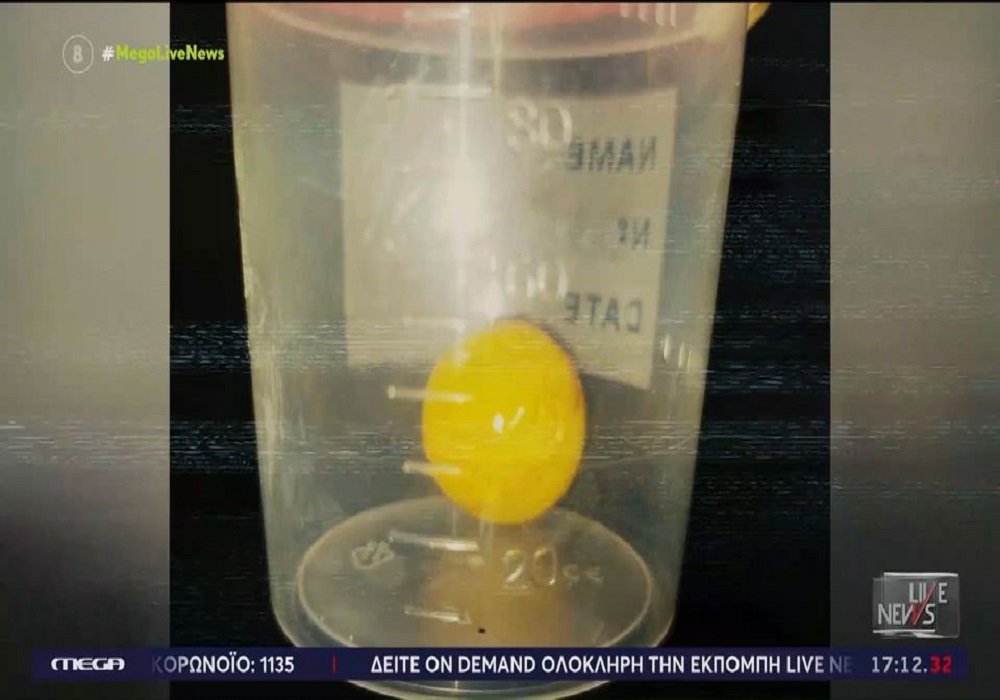 Αμαλιάδα: Καρδιοχτύπι για το μωρό που κατάπιε μπαλάκι – «Σώθηκε για δευτερόλεπτα» (VIDEO)