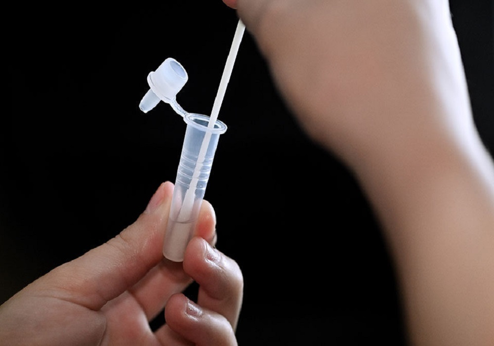 Θεσσαλονίκη: Διπλασιάστηκε η ζήτηση σε rapid και self test στα φαρμακεία