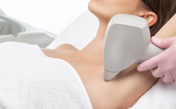 Αποτρίχωση: Ποιες γυναίκες  επωφελούνται περισσότερο