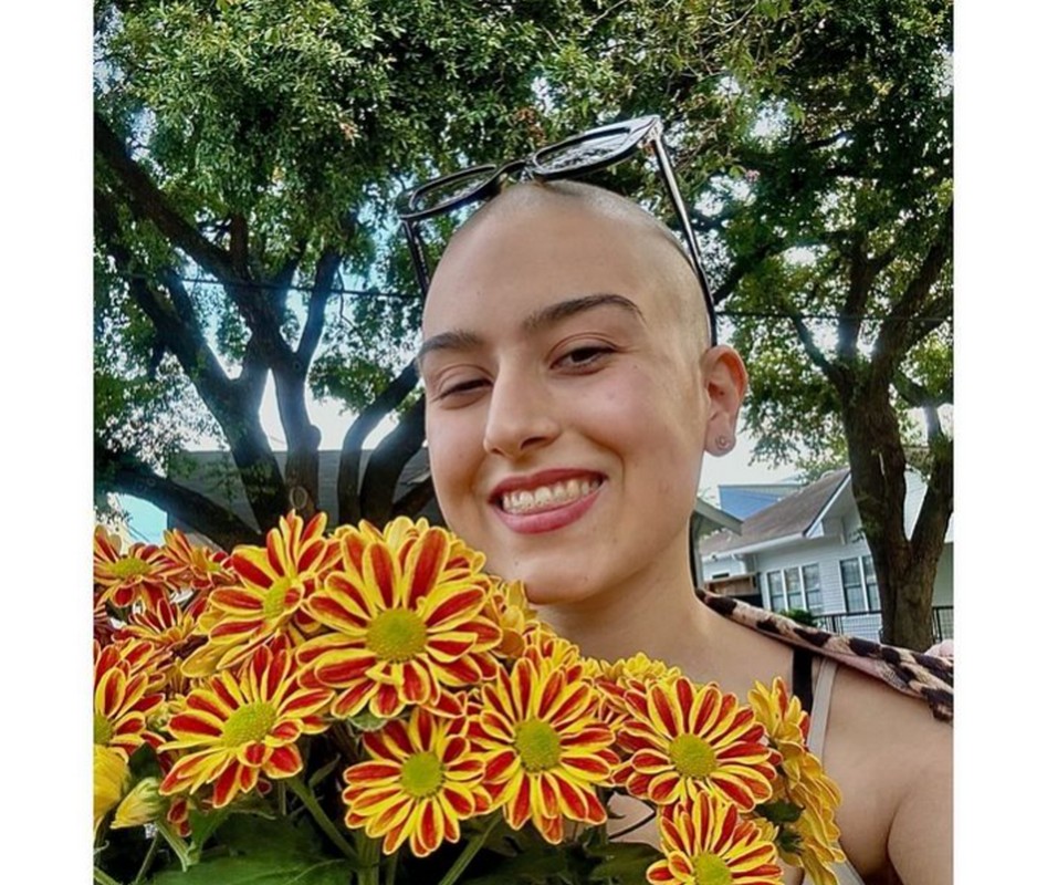 Πέθανε η Ραφαέλα Πιτσικάλη: Έδινε μεγάλη μάχη με σπάνια μορφή καρκίνου