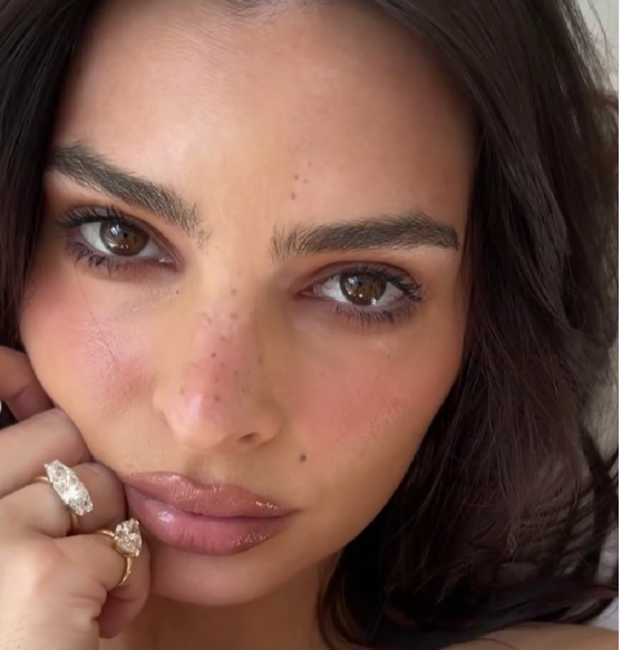 Η νέα μόδα με τα δαχτυλίδια… διαζυγίου (ΦΩΤΟ)