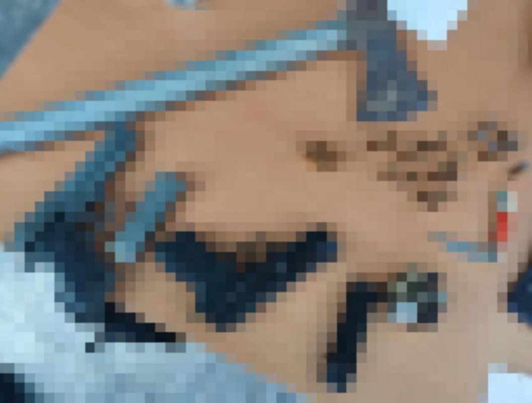 Θεσσαλονίκη: Απείλησε με πυροβόλο όπλο τη 49χρονη πρώην σύζυγό του (ΦΩΤΟ)