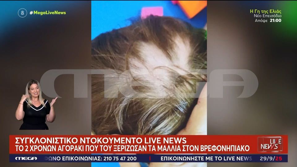 Σοκαριστική φωτογραφία από το 2χρονο αγοράκι που του ξερίζωσαν τα μαλλιά σε βρεφονηπιακό σταθμό (VIDEO)