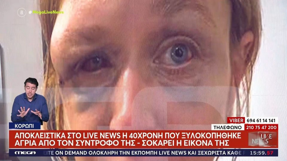 «Δεν πιστεύω ότι μου επιτέθηκε ο σύντροφός μου, μπορεί οι γείτονες», λέει η 40χρονη που ξυλοκοπήθηκε στο Κορωπί (VIDEO)