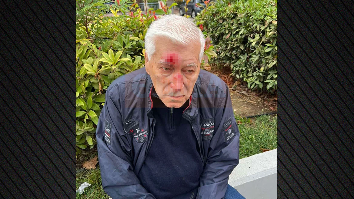 Θεσσαλονίκη: 82χρονος οδηγός κατήγγειλε ότι τον γρονθοκόπησε γιατρός στη μέση του δρόμου – «Μου έριξε δύο μπουνιές στο πρόσωπο και με έριξε κάτω» (ΦΩΤΟ)