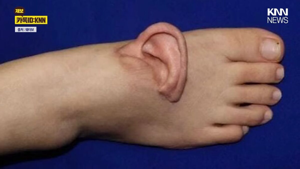 Φορούσε το κομμένο αυτί στο πόδι της για 5 μήνες (VIDEO)